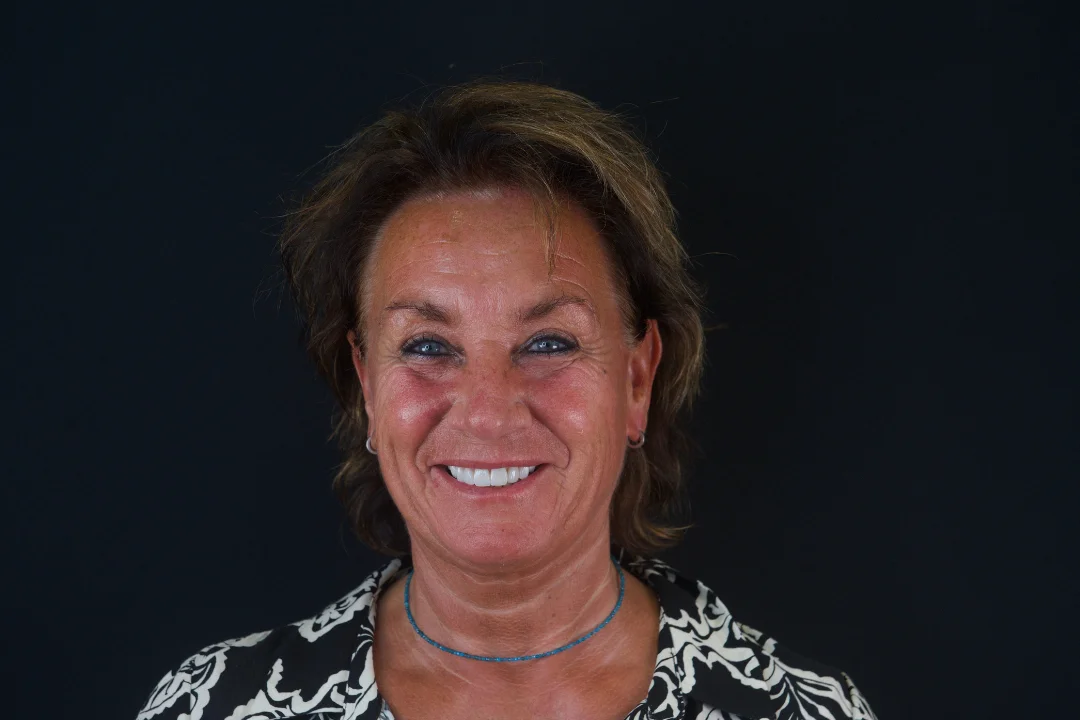 Carillas de Porcelana - Angelique 4 Carillas de Porcelana - Angelique 4