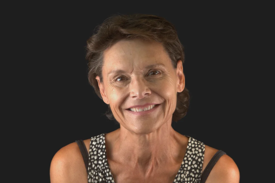 Caso clínico carillas dentales Edith – Clínica Dental Herrera Torre del Mar antes